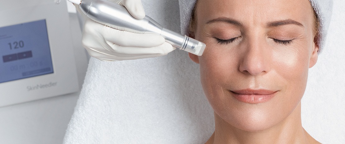 Ästhetisches Microneedling